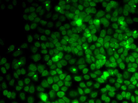 Immunofluorescence analysis of MCF7 cells using UFD1L antibody 