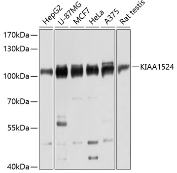 a32369 cip2a primary antiboties wb testing 1