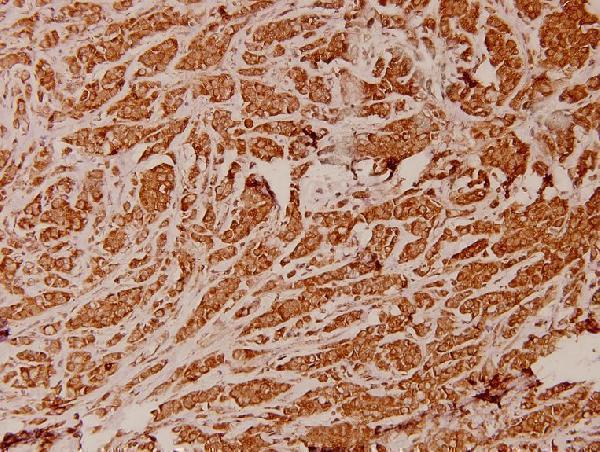 a32370 atp5me primary antiboties ihc testing 2