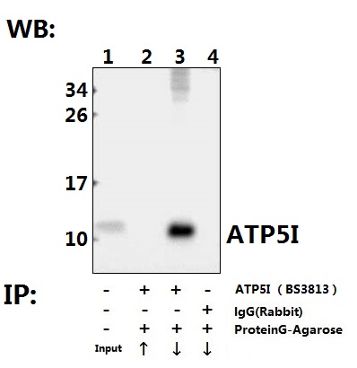 a32370 atp5me primary antiboties ip testing 3