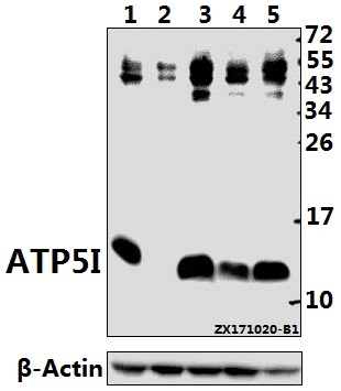 a32370 atp5me primary antiboties wb testing 1