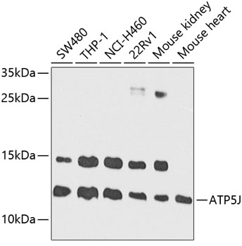a32371 atp5pf primary antiboties wb testing 1