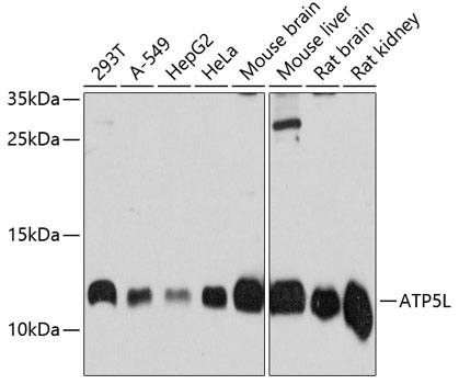 a32372 atp5mg primary antiboties wb testing 1