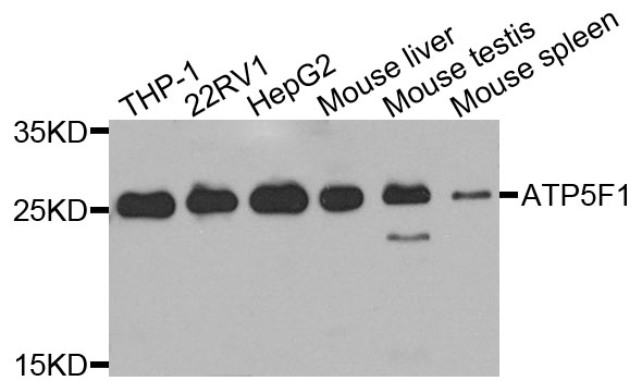 Western blot analysis of extracts of various cells, using ATP5F1 antibody