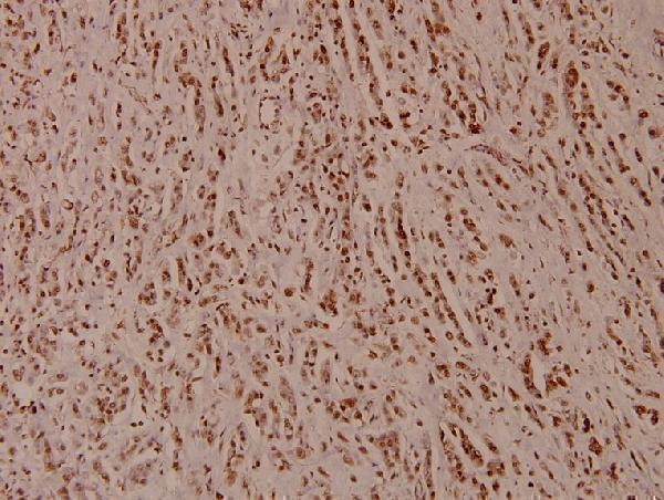 a32377 atp5pd primary antiboties ihc testing 2