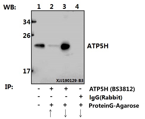 a32377 atp5pd primary antiboties ip testing 3