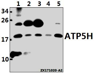 a32377 atp5pd primary antiboties wb testing 1