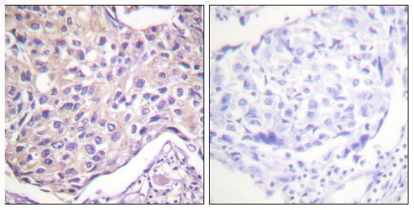a32388s29 grk2 primary antibodies ihc testing 3