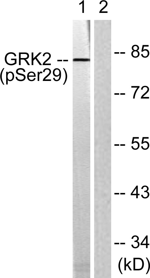 a32388s29 grk2 primary antibodies wb testing 2
