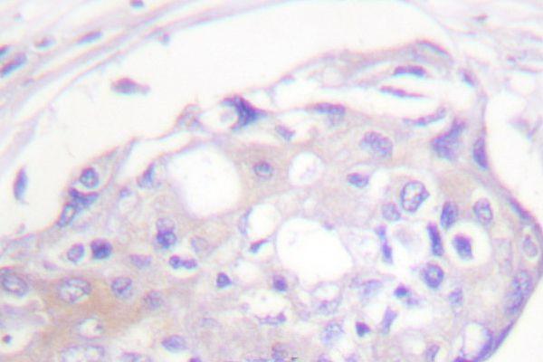 a32388t23 grk2 primary antiboties ihc testing 2
