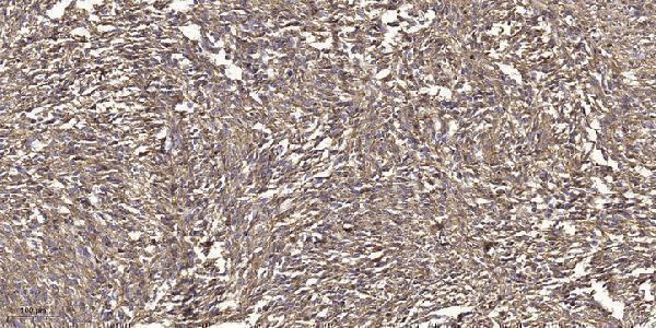 a32388y86 grk2 primary antibodies ihc testing 1