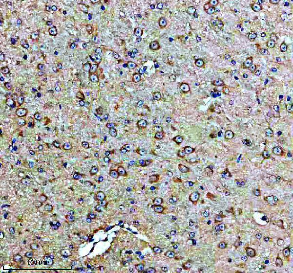 IHC analysis of GUCY1B3 using anti-GUCY1B3 antibody (A32396-1)