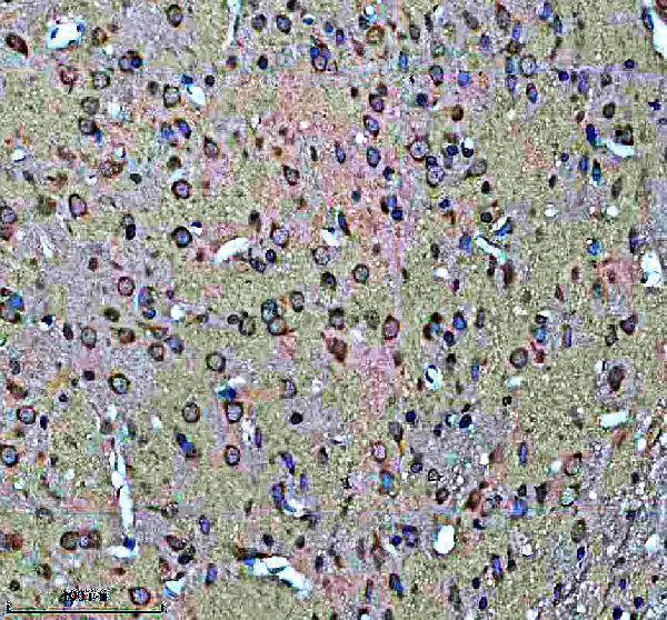 IHC analysis of GUCY1B3 using anti-GUCY1B3 antibody (A32396-1)