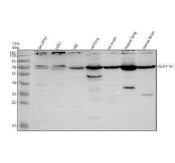 Western blot analysis of GUCY1B3 using anti-GUCY1B3 antibody (A32396-1)