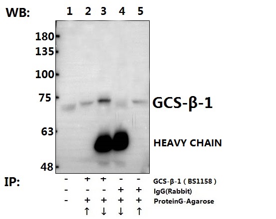 Immunoprecipitation of the Brain tissue lysate of Mouse using GCS-β-1 (V21) pAb (Sepharose Bead Conjugate) #BD0048(lane 2 and lane 3) and Nonspecific IgG  Control (Sepharose Bead Conjugate)#BD0048 (lane 4 and lane 5) 