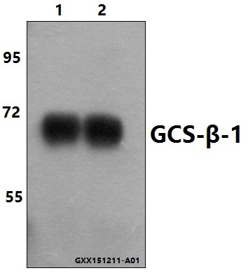 Western blot (WB) analysis of GCS-β-1 (V21) polyclonal antibody at 1:500 dilution
Lane1:The Lung tissue lysate of Mouse
Lane2:The Brain tissue lysate of Rat