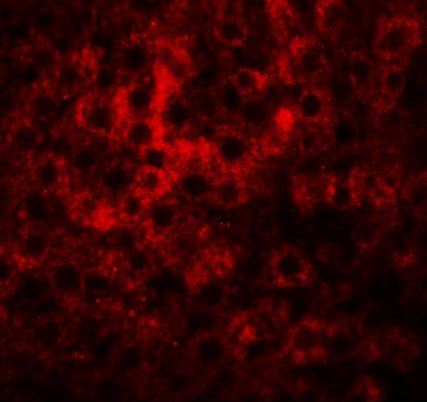 a32401 hdgfrp2 primary antibodies if testing 3