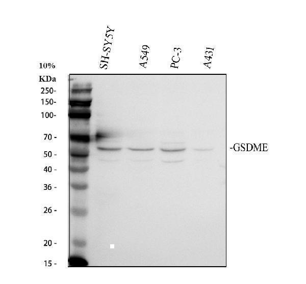  Western blot analysis of DFNA5/GSDME using anti-DFNA5/GSDME antibody (A32407-2)