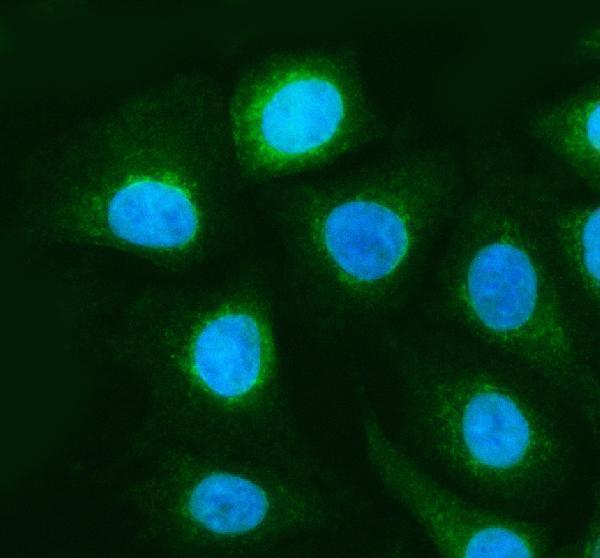 a32407 2 gsdme primary antibodies if testing 1