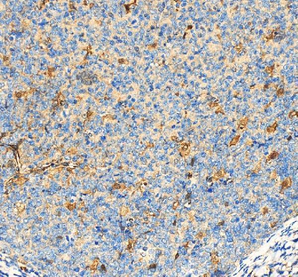 IHC analysis of DFNA5/GSDME using anti-DFNA5/GSDME antibody (A32407-2)