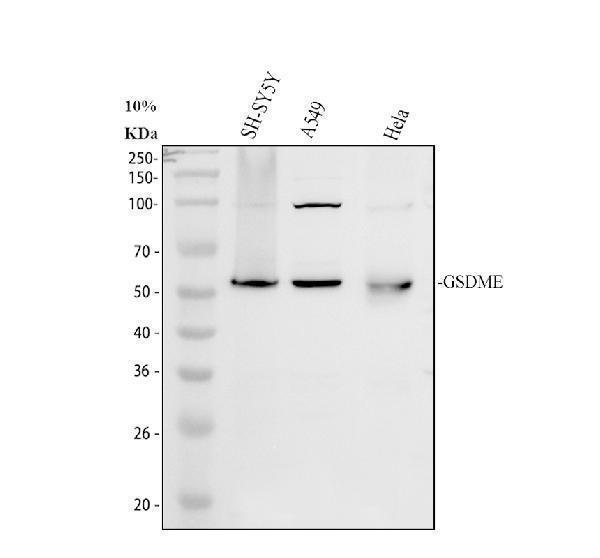 Western blot analysis of GSDME using anti-GSDME antibody (A32407-2)