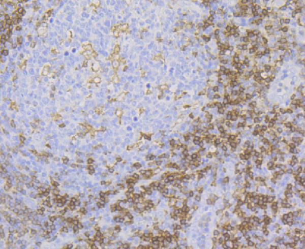a32410 1 fyb1 primary antiboties ihc testing 2