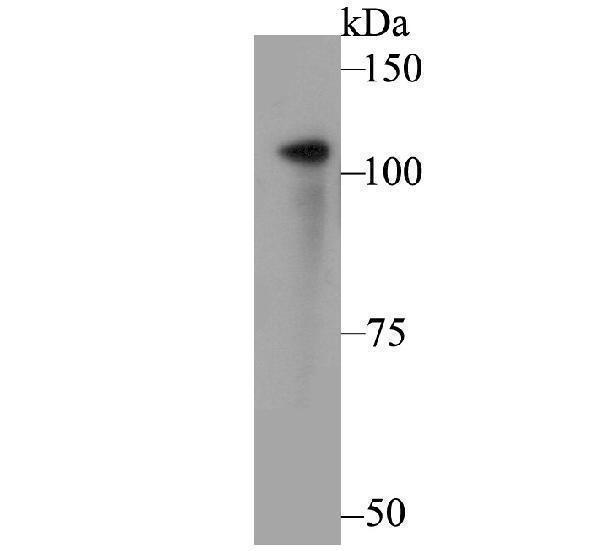 a32410 1 fyb1 primary antiboties wb testing 1