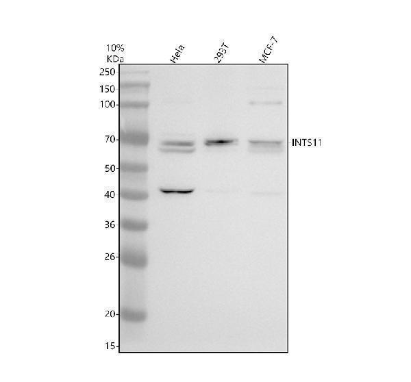 Western blot analysis of INTS11 using anti-INTS11 antibody (A32417-1)