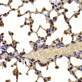 a32441 nsd2 primary antiboties ihc testing 2