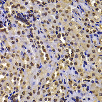 a32441 nsd2 primary antiboties ihc testing 3