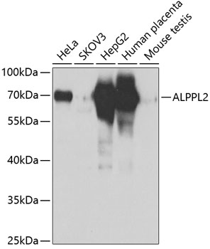 Western blot analysis of extracts of various cell lines, using ALPPL2 antibody  at 1:1000 dilution