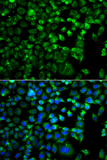 Immunofluorescence analysis of A549 cells using ZAK antibody 