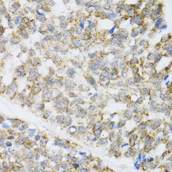 a32464 map3k20 primary antiboties ihc testing 3