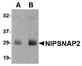 a32476 gbas primary antibodies wb testing 1
