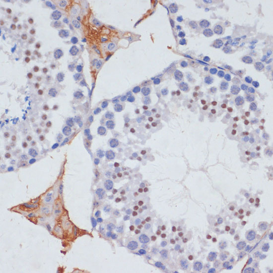 Immunohistochemistry of paraffin-embedded mouse testis using SKIV2L2 antibody  at dilution of 1:100 