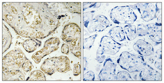 a32790 apobec3 primary antibodyes ihc testing 1