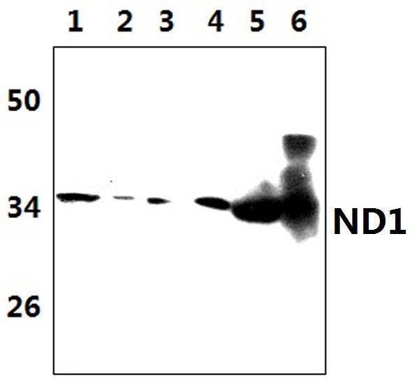 a32847 mtnd1 primary antiboties wb testing 1