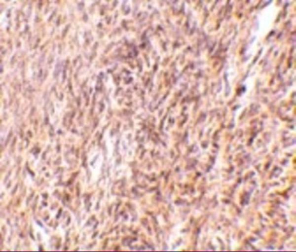 Immunohistochemistry of TRIM30 in mouse ovary tissue with TRIM30 antibody at 10 μg/mL