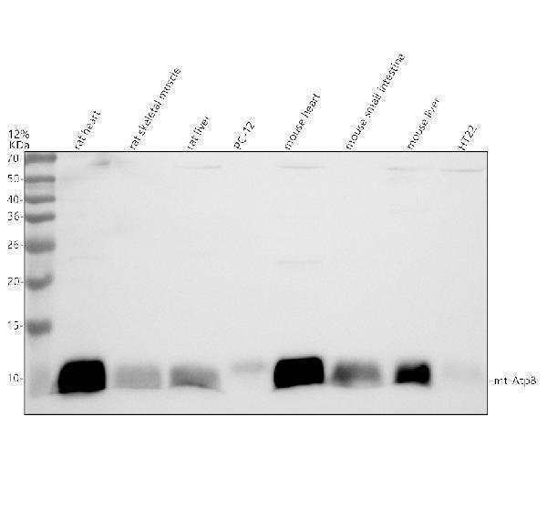 Western blot analysis of ATP8/MT-ATP8 using anti-ATP8/MT-ATP8 antibody (A33371-1)
