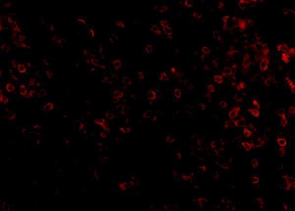 Immunofluorescence of KLRA1 in Human Spleen cells with KLRA1 antibody at 20 μg/mL