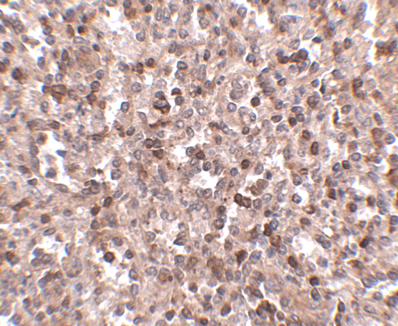 Immunohistochemistry of KLRA1 in human spleen tissue with KLRA1 antibody at 2