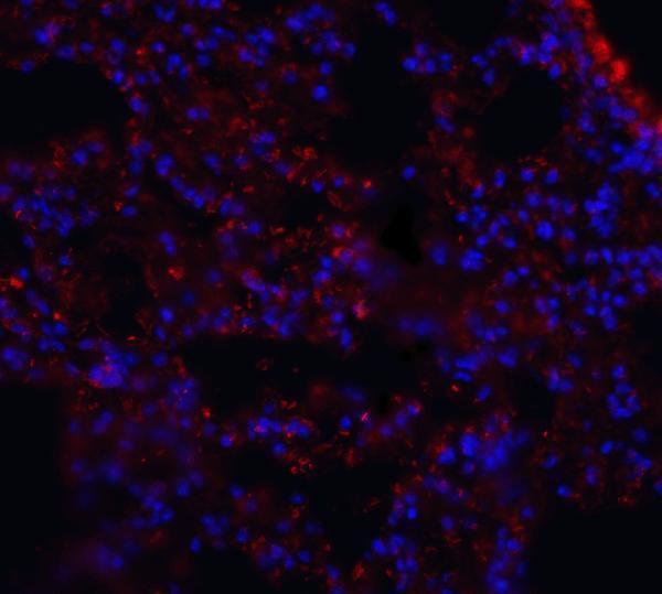 a33936 mfsd2aa primary antibodies if testing 5