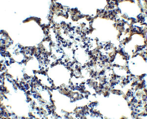 a33936 mfsd2aa primary antibodies ihc testing 2