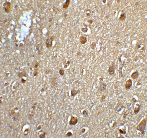 a33936 mfsd2aa primary antibodies ihc testing 6