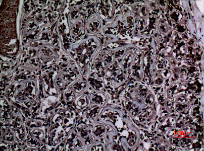 Immunohistochemical analysis of paraffin-embedded human-breast, antibody was diluted at 1:100
