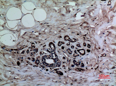 Immunohistochemical analysis of paraffin-embedded human-breast, antibody was diluted at 1:100