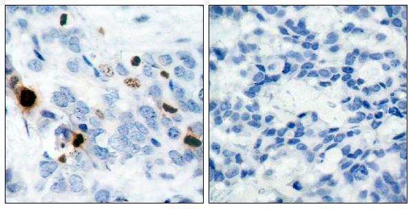 a33947s10 h3c1 primary antibodies if testing 5