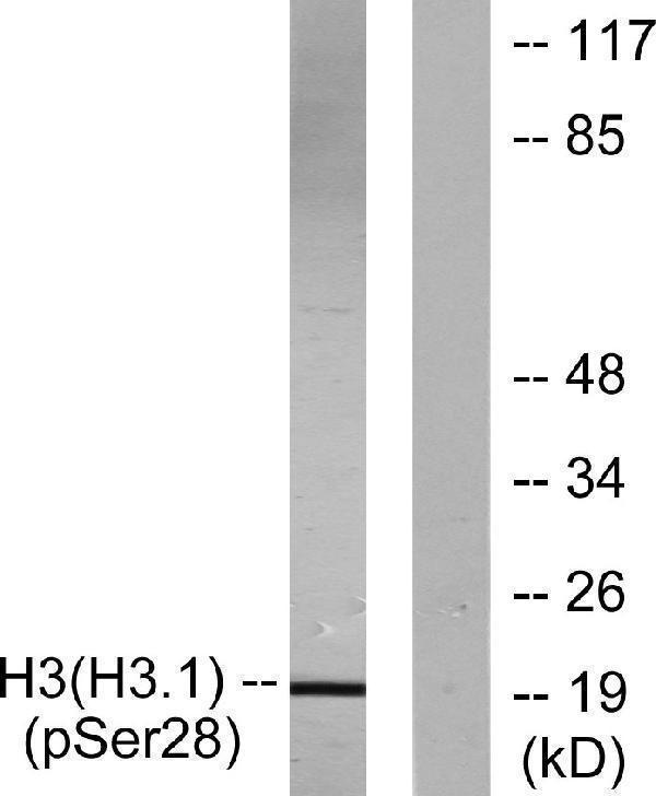 Western blot analysis of lysates from HUVEC cells treated with Serum 20% 30