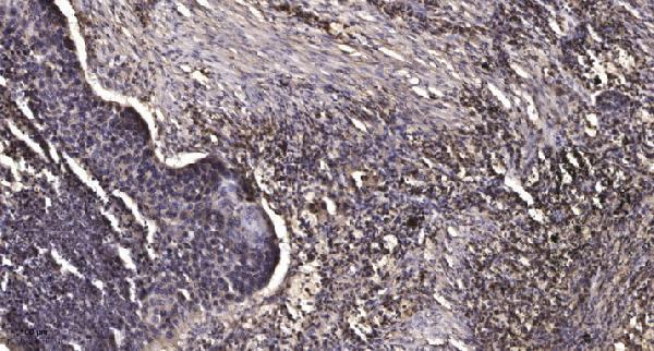 a33953 mmp23b primary antibodies ihc testing 1