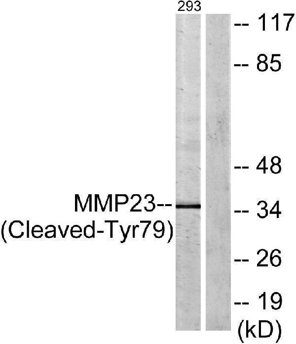 Western blot analysis of lysates from 293 cells, treated with etoposide 25uM 1h, using MMP23 (Cleaved-Tyr79) Antibody